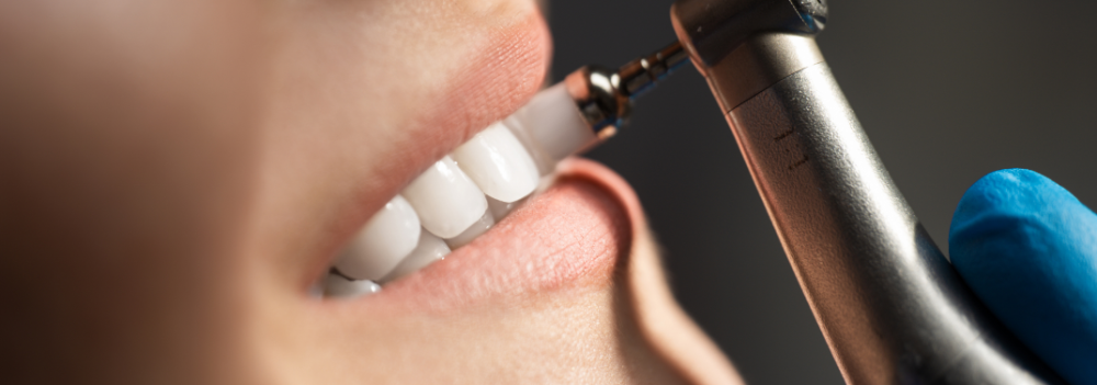 limpeza_dental