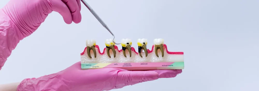 periodontia