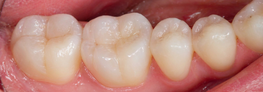 restauracoes_odontologicas